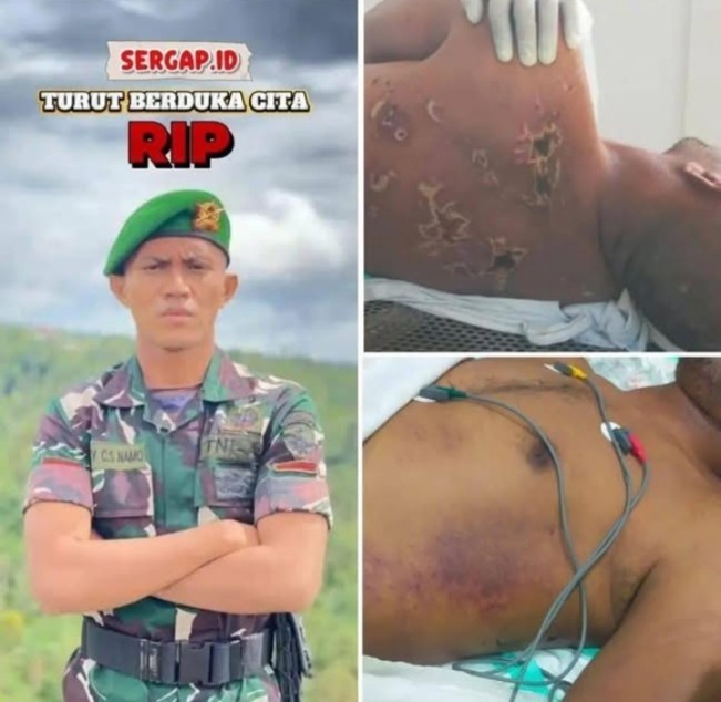 Dua foto yang beredar menunjukkan kondisi Prada Lucky yang diduga tewas akibat dianiaya senior. [Instagram]